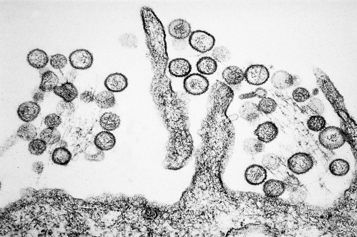 Highly deadly strain of Hantavirus spreads from cruise ship outbreak.